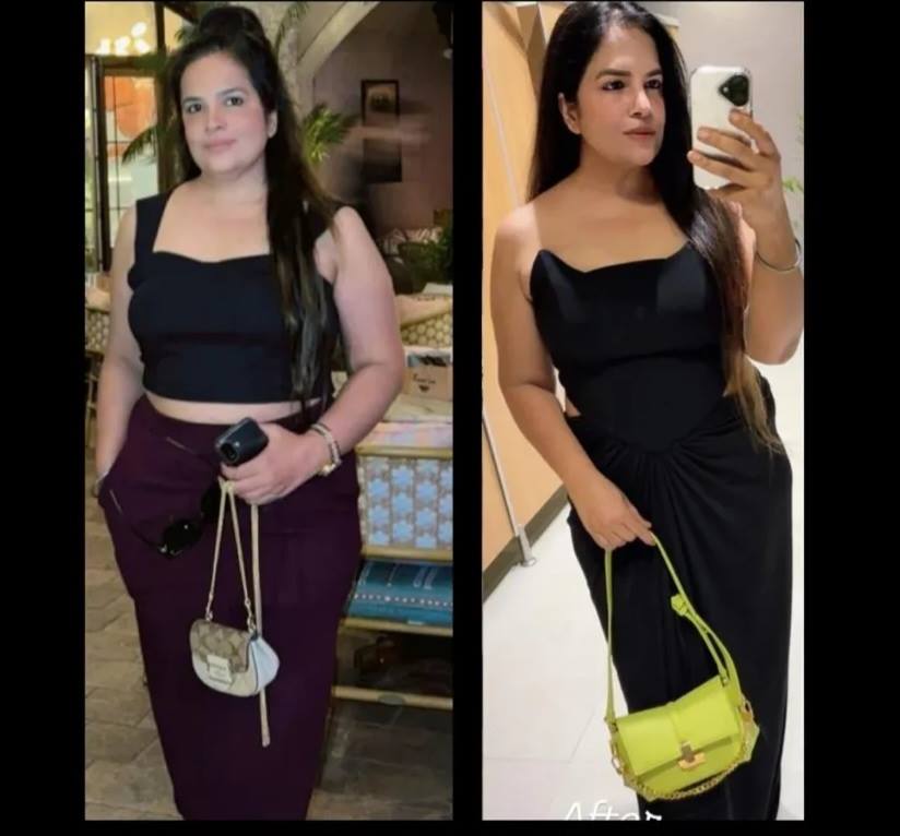 Sheetal — before and after transformation